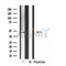 DF4507 staining HeLa by IF/ICC. The sample were fixed with PFA and permeabilized in 0.1% Triton X-100,then blocked in 10% serum for 45 minutes at 25¡ãC. The primary antibody was diluted at 1/200 and incubated with the sample for 1 hour at 37¡ãC. An  Alexa Fluor 594 conjugated goat anti-rabbit IgG (H+L) Ab, diluted at 1/600, was used as the secondary antibod