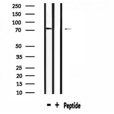 DF4509 staining HuvEc by IF/ICC. The sample were fixed with PFA and permeabilized in 0.1% Triton X-100,then blocked in 10% serum for 45 minutes at 25¡ãC. The primary antibody was diluted at 1/200 and incubated with the sample for 1 hour at 37¡ãC. An  Alexa Fluor 594 conjugated goat anti-rabbit IgG (H+L) Ab, diluted at 1/600, was used as the secondary antibod