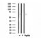 DF4510 staining Hela by IF/ICC. The sample were fixed with PFA and permeabilized in 0.1% Triton X-100,then blocked in 10% serum for 45 minutes at 25¡ãC. The primary antibody was diluted at 1/200 and incubated with the sample for 1 hour at 37¡ãC. An  Alexa Fluor 594 conjugated goat anti-rabbit IgG (H+L) Ab, diluted at 1/600, was used as the secondary antibod