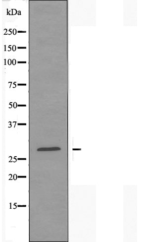 DF4512 staining HepG2 by IF/ICC. The sample were fixed with PFA and permeabilized in 0.1% Triton X-100,then blocked in 10% serum for 45 minutes at 25¡ãC. The primary antibody was diluted at 1/200 and incubated with the sample for 1 hour at 37¡ãC. An  Alexa Fluor 594 conjugated goat anti-rabbit IgG (H+L) Ab, diluted at 1/600, was used as the secondary antibod