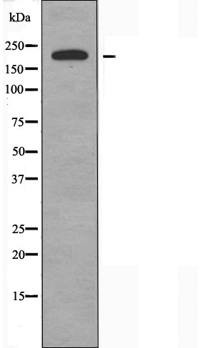 DF4513 staining Hela by IF/ICC. The sample were fixed with PFA and permeabilized in 0.1% Triton X-100,then blocked in 10% serum for 45 minutes at 25¡ãC. The primary antibody was diluted at 1/200 and incubated with the sample for 1 hour at 37¡ãC. An  Alexa Fluor 594 conjugated goat anti-rabbit IgG (H+L) Ab, diluted at 1/600, was used as the secondary antibod