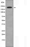 DF4513 staining Hela by IF/ICC. The sample were fixed with PFA and permeabilized in 0.1% Triton X-100,then blocked in 10% serum for 45 minutes at 25¡ãC. The primary antibody was diluted at 1/200 and incubated with the sample for 1 hour at 37¡ãC. An  Alexa Fluor 594 conjugated goat anti-rabbit IgG (H+L) Ab, diluted at 1/600, was used as the secondary antibod
