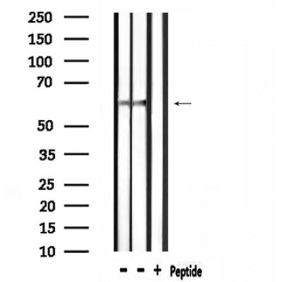 DF4519 staining Hela by IF/ICC. The sample were fixed with PFA and permeabilized in 0.1% Triton X-100,then blocked in 10% serum for 45 minutes at 25¡ãC. The primary antibody was diluted at 1/200 and incubated with the sample for 1 hour at 37¡ãC. An  Alexa Fluor 594 conjugated goat anti-rabbit IgG (H+L) Ab, diluted at 1/600, was used as the secondary antibod