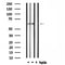 DF4519 staining Hela by IF/ICC. The sample were fixed with PFA and permeabilized in 0.1% Triton X-100,then blocked in 10% serum for 45 minutes at 25¡ãC. The primary antibody was diluted at 1/200 and incubated with the sample for 1 hour at 37¡ãC. An  Alexa Fluor 594 conjugated goat anti-rabbit IgG (H+L) Ab, diluted at 1/600, was used as the secondary antibod