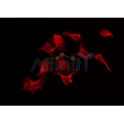 Western blot analysis of extracts from 293, using SLC5A3 Antibody. Lane 1 was treated with the blocking peptide.