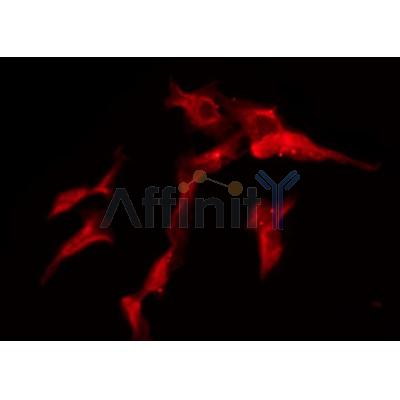 DF4522 staining Hela by IF/ICC. The samples were fixed with PFA and permeabilized in 0.1% Triton X-100,then blocked in 10% serum for 45 minutes at 25¡ãC. Samples were then incubated with primary Ab(DF4522 1:200) and mouse anti-beta tubulin Ab(T0023 1:200) for 1 hour at 37¡ãC. An  AlexaFluor594 conjugated goat anti-rabbit IgG(H+L) Ab(S0006 Red 1:600) and an AlexaFluor488 conjugated goat anti-mouse IgG(H+L) Ab(S0017 Green 1:600) were used as the secondary antibod