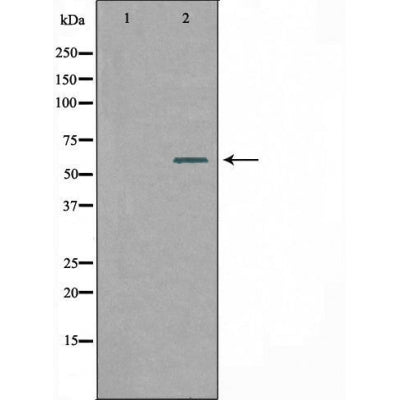 DF4525 staining RAW264.7 by IF/ICC. The sample were fixed with PFA and permeabilized in 0.1% Triton X-100,then blocked in 10% serum for 45 minutes at 25¡ãC. The primary antibody was diluted at 1/200 and incubated with the sample for 1 hour at 37¡ãC. An  Alexa Fluor 594 conjugated goat anti-rabbit IgG (H+L) Ab, diluted at 1/600, was used as the secondary antibod