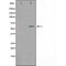 DF4525 staining RAW264.7 by IF/ICC. The sample were fixed with PFA and permeabilized in 0.1% Triton X-100,then blocked in 10% serum for 45 minutes at 25¡ãC. The primary antibody was diluted at 1/200 and incubated with the sample for 1 hour at 37¡ãC. An  Alexa Fluor 594 conjugated goat anti-rabbit IgG (H+L) Ab, diluted at 1/600, was used as the secondary antibod
