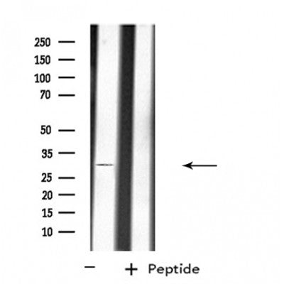 DF4528 staining Hela by IF/ICC. The sample were fixed with PFA and permeabilized in 0.1% Triton X-100,then blocked in 10% serum for 45 minutes at 25¡ãC. The primary antibody was diluted at 1/200 and incubated with the sample for 1 hour at 37¡ãC. An  Alexa Fluor 594 conjugated goat anti-rabbit IgG (H+L) Ab, diluted at 1/600, was used as the secondary antibod