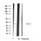 DF4528 staining Hela by IF/ICC. The sample were fixed with PFA and permeabilized in 0.1% Triton X-100,then blocked in 10% serum for 45 minutes at 25¡ãC. The primary antibody was diluted at 1/200 and incubated with the sample for 1 hour at 37¡ãC. An  Alexa Fluor 594 conjugated goat anti-rabbit IgG (H+L) Ab, diluted at 1/600, was used as the secondary antibod