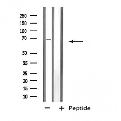 Western blot analysis of extracts from Rat brain lysate, using SLC6A3 antibody.