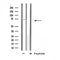 Western blot analysis of extracts from Rat brain lysate, using SLC6A3 antibody.
