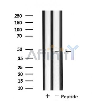 DF4531 staining HepG2 by IF/ICC. The sample were fixed with PFA and permeabilized in 0.1% Triton X-100,then blocked in 10% serum for 45 minutes at 25¡ãC. The primary antibody was diluted at 1/200 and incubated with the sample for 1 hour at 37¡ãC. An  Alexa Fluor 594 conjugated goat anti-rabbit IgG (H+L) Ab, diluted at 1/600, was used as the secondary antibod