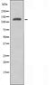DF4532 staining COLO205 by IF/ICC. The sample were fixed with PFA and permeabilized in 0.1% Triton X-100,then blocked in 10% serum for 45 minutes at 25¡ãC. The primary antibody was diluted at 1/200 and incubated with the sample for 1 hour at 37¡ãC. An  Alexa Fluor 594 conjugated goat anti-rabbit IgG (H+L) Ab, diluted at 1/600, was used as the secondary antibod