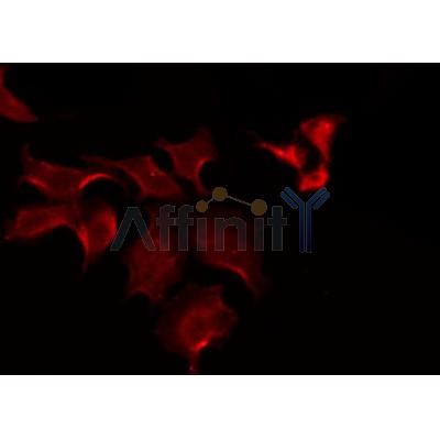 Western blot analysis of extracts from mouse muscle, using SLCO1B1 Antibody.