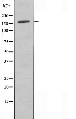 DF4535 staining Hela cells by IF/ICC. The sample were fixed with PFA and permeabilized in 0.1% Triton X-100,then blocked in 10% serum for 45 minutes at 25¡ãC. The primary antibody was diluted at 1/200 and incubated with the sample for 1 hour at 37¡ãC. An  Alexa Fluor 594 conjugated goat anti-rabbit IgG (H+L) antibody(Cat.# S0006), diluted at 1/600, was used as secondary antibod