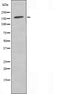 DF4535 staining Hela cells by IF/ICC. The sample were fixed with PFA and permeabilized in 0.1% Triton X-100,then blocked in 10% serum for 45 minutes at 25¡ãC. The primary antibody was diluted at 1/200 and incubated with the sample for 1 hour at 37¡ãC. An  Alexa Fluor 594 conjugated goat anti-rabbit IgG (H+L) antibody(Cat.# S0006), diluted at 1/600, was used as secondary antibod