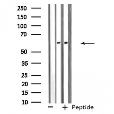 DF4536 staining Hela cells by IF/ICC. The sample were fixed with PFA and permeabilized in 0.1% Triton X-100,then blocked in 10% serum for 45 minutes at 25¡ãC. The primary antibody was diluted at 1/200 and incubated with the sample for 1 hour at 37¡ãC. An  Alexa Fluor 594 conjugated goat anti-rabbit IgG (H+L) antibody(Cat.# S0006), diluted at 1/600, was used as secondary antibod