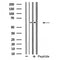 DF4536 staining Hela cells by IF/ICC. The sample were fixed with PFA and permeabilized in 0.1% Triton X-100,then blocked in 10% serum for 45 minutes at 25¡ãC. The primary antibody was diluted at 1/200 and incubated with the sample for 1 hour at 37¡ãC. An  Alexa Fluor 594 conjugated goat anti-rabbit IgG (H+L) antibody(Cat.# S0006), diluted at 1/600, was used as secondary antibod