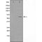 DF4538 staining HuvEc cells by IF/ICC. The sample were fixed with PFA and permeabilized in 0.1% Triton X-100,then blocked in 10% serum for 45 minutes at 25¡ãC. The primary antibody was diluted at 1/200 and incubated with the sample for 1 hour at 37¡ãC. An  Alexa Fluor 594 conjugated goat anti-rabbit IgG (H+L) antibody(Cat.# S0006), diluted at 1/600, was used as secondary antibod