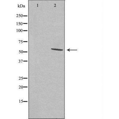 DF4541 staining LOVO by IF/ICC. The sample were fixed with PFA and permeabilized in 0.1% Triton X-100,then blocked in 10% serum for 45 minutes at 25¡ãC. The primary antibody was diluted at 1/200 and incubated with the sample for 1 hour at 37¡ãC. An  Alexa Fluor 594 conjugated goat anti-rabbit IgG (H+L) Ab, diluted at 1/600, was used as the secondary antibod