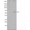 Western blot analysis of extracts from COLO cells, using STK39 antibody.The lane on the left is treated with the antigen-specific peptide.