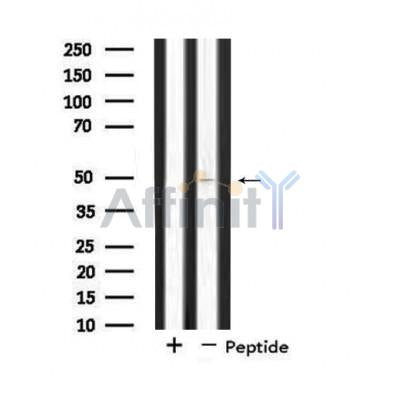 DF4552 staining  CoLo205 cells by IF/ICC. The sample were fixed with PFA and permeabilized in 0.1% Triton X-100,then blocked in 10% serum for 45 minutes at 25¡ãC. The primary antibody was diluted at 1/200 and incubated with the sample for 1 hour at 37¡ãC. An  Alexa Fluor 594 conjugated goat anti-rabbit IgG (H+L) antibody(Cat.# S0006), diluted at 1/600, was used as secondary antibod