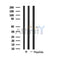 DF4552 staining  CoLo205 cells by IF/ICC. The sample were fixed with PFA and permeabilized in 0.1% Triton X-100,then blocked in 10% serum for 45 minutes at 25¡ãC. The primary antibody was diluted at 1/200 and incubated with the sample for 1 hour at 37¡ãC. An  Alexa Fluor 594 conjugated goat anti-rabbit IgG (H+L) antibody(Cat.# S0006), diluted at 1/600, was used as secondary antibod