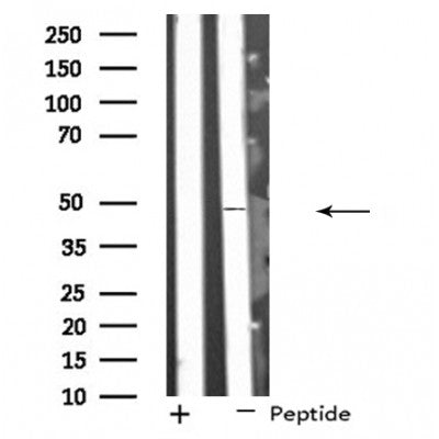 DF4553 staining HuvEc by IF/ICC. The sample were fixed with PFA and permeabilized in 0.1% Triton X-100,then blocked in 10% serum for 45 minutes at 25¡ãC. The primary antibody was diluted at 1/200 and incubated with the sample for 1 hour at 37¡ãC. An  Alexa Fluor 594 conjugated goat anti-rabbit IgG (H+L) Ab, diluted at 1/600, was used as the secondary antibod