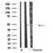 DF4553 staining HuvEc by IF/ICC. The sample were fixed with PFA and permeabilized in 0.1% Triton X-100,then blocked in 10% serum for 45 minutes at 25¡ãC. The primary antibody was diluted at 1/200 and incubated with the sample for 1 hour at 37¡ãC. An  Alexa Fluor 594 conjugated goat anti-rabbit IgG (H+L) Ab, diluted at 1/600, was used as the secondary antibod