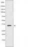 DF4558 staining  HepG2 cells by IF/ICC. The sample were fixed with PFA and permeabilized in 0.1% Triton X-100,then blocked in 10% serum for 45 minutes at 25¡ãC. The primary antibody was diluted at 1/200 and incubated with the sample for 1 hour at 37¡ãC. An  Alexa Fluor 594 conjugated goat anti-rabbit IgG (H+L) antibody(Cat.# S0006), diluted at 1/600, was used as secondary antibod