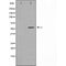 DF4561 staining HeLa by IF/ICC. The sample were fixed with PFA and permeabilized in 0.1% Triton X-100,then blocked in 10% serum for 45 minutes at 25¡ãC. The primary antibody was diluted at 1/200 and incubated with the sample for 1 hour at 37¡ãC. An  Alexa Fluor 594 conjugated goat anti-rabbit IgG (H+L) Ab, diluted at 1/600, was used as the secondary antibod