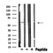 DF4565 staining Hela by IF/ICC. The sample were fixed with PFA and permeabilized in 0.1% Triton X-100,then blocked in 10% serum for 45 minutes at 25¡ãC. The primary antibody was diluted at 1/200 and incubated with the sample for 1 hour at 37¡ãC. An  Alexa Fluor 594 conjugated goat anti-rabbit IgG (H+L) Ab, diluted at 1/600, was used as the secondary antibod