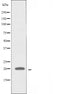 DF4570 staining HepG2 by IF/ICC. The sample were fixed with PFA and permeabilized in 0.1% Triton X-100,then blocked in 10% serum for 45 minutes at 25¡ãC. The primary antibody was diluted at 1/200 and incubated with the sample for 1 hour at 37¡ãC. An  Alexa Fluor 594 conjugated goat anti-rabbit IgG (H+L) Ab, diluted at 1/600, was used as the secondary antibod