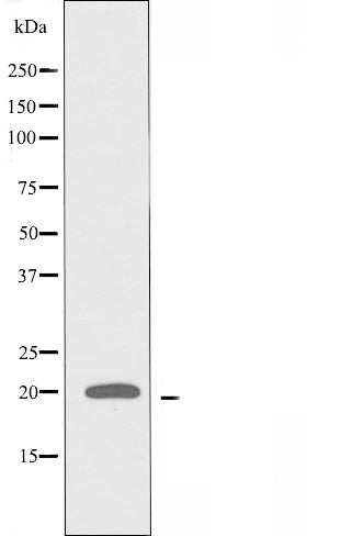 DF4570 staining HepG2 by IF/ICC. The sample were fixed with PFA and permeabilized in 0.1% Triton X-100,then blocked in 10% serum for 45 minutes at 25¡ãC. The primary antibody was diluted at 1/200 and incubated with the sample for 1 hour at 37¡ãC. An  Alexa Fluor 594 conjugated goat anti-rabbit IgG (H+L) Ab, diluted at 1/600, was used as the secondary antibod