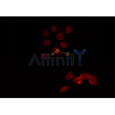 AF0341 staining Hela by IF/ICC. The sample were fixed with PFA and permeabilized in 0.1% Triton X-100,then blocked in 10% serum for 45 minutes at 25¡ãC. The primary antibody was diluted at 1/200 and incubated with the sample for 1 hour at 37¡ãC. An  Alexa Fluor 594 conjugated goat anti-rabbit IgG (H+L) Ab, diluted at 1/600, was used as the secondary antibod