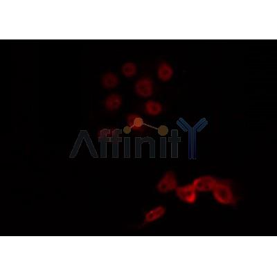 AF0341 staining Hela by IF/ICC. The sample were fixed with PFA and permeabilized in 0.1% Triton X-100,then blocked in 10% serum for 45 minutes at 25¡ãC. The primary antibody was diluted at 1/200 and incubated with the sample for 1 hour at 37¡ãC. An  Alexa Fluor 594 conjugated goat anti-rabbit IgG (H+L) Ab, diluted at 1/600, was used as the secondary antibod