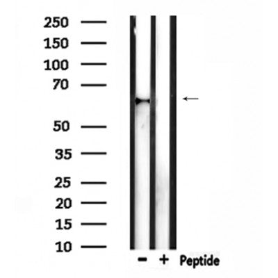 DF4573 staining  NIH-3T3 cells by IF/ICC. The sample were fixed with PFA and permeabilized in 0.1% Triton X-100,then blocked in 10% serum for 45 minutes at 25¡ãC. The primary antibody was diluted at 1/200 and incubated with the sample for 1 hour at 37¡ãC. An  Alexa Fluor 594 conjugated goat anti-rabbit IgG (H+L) antibody(Cat.# S0006), diluted at 1/600, was used as secondary antibod