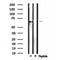 DF4573 staining  NIH-3T3 cells by IF/ICC. The sample were fixed with PFA and permeabilized in 0.1% Triton X-100,then blocked in 10% serum for 45 minutes at 25¡ãC. The primary antibody was diluted at 1/200 and incubated with the sample for 1 hour at 37¡ãC. An  Alexa Fluor 594 conjugated goat anti-rabbit IgG (H+L) antibody(Cat.# S0006), diluted at 1/600, was used as secondary antibod
