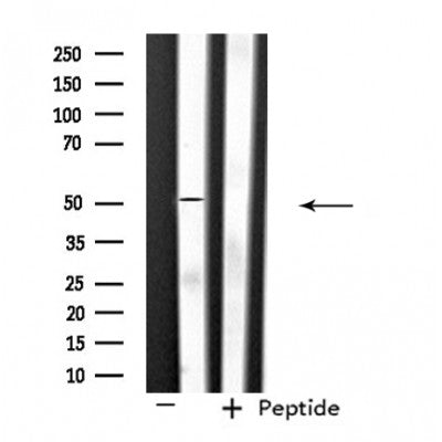 Western blot analysis of extracts from mouse brain, using SLC39A7 Antibody.