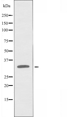 DF4636 staining A549 by IF/ICC. The sample were fixed with PFA and permeabilized in 0.1% Triton X-100,then blocked in 10% serum for 45 minutes at 25¡ãC. The primary antibody was diluted at 1/200 and incubated with the sample for 1 hour at 37¡ãC. An  Alexa Fluor 594 conjugated goat anti-rabbit IgG (H+L) Ab, diluted at 1/600, was used as the secondary antibod
