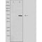DF4638 staining  COLO205 cells by IF/ICC. The sample were fixed with PFA and permeabilized in 0.1% Triton X-100,then blocked in 10% serum for 45 minutes at 25¡ãC. The primary antibody was diluted at 1/200 and incubated with the sample for 1 hour at 37¡ãC. An  Alexa Fluor 594 conjugated goat anti-rabbit IgG (H+L) antibody(Cat.# S0006), diluted at 1/600, was used as secondary antibod