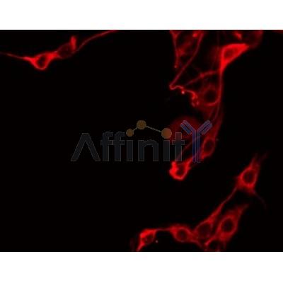 Western blot analysis of extracts from rat heart, using ZADH1 Antibody. Lane 1 was treated with the blocking peptide.