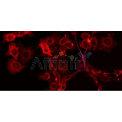 DF4640 staining HepG2 by IF/ICC. The sample were fixed with PFA and permeabilized in 0.1% Triton X-100,then blocked in 10% serum for 45 minutes at 25¡ãC. The primary antibody was diluted at 1/200 and incubated with the sample for 1 hour at 37¡ãC. An  Alexa Fluor 594 conjugated goat anti-rabbit IgG (H+L) Ab, diluted at 1/600, was used as the secondary antibod