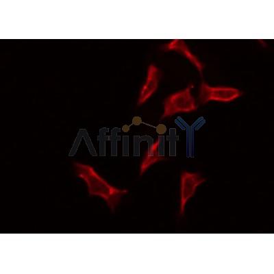 Western blot analysis of extracts from various samples, using ZP4 Antibody. lane 1: rat brain; lane 2: mouse brain; 