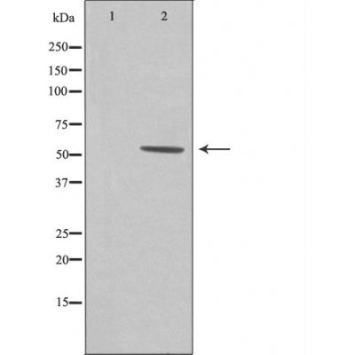 DF4643 staining Hela by IF/ICC. The sample were fixed with PFA and permeabilized in 0.1% Triton X-100,then blocked in 10% serum for 45 minutes at 25¡ãC. The primary antibody was diluted at 1/200 and incubated with the sample for 1 hour at 37¡ãC. An  Alexa Fluor 594 conjugated goat anti-rabbit IgG (H+L) Ab, diluted at 1/600, was used as the secondary antibod