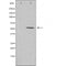 DF4643 staining Hela by IF/ICC. The sample were fixed with PFA and permeabilized in 0.1% Triton X-100,then blocked in 10% serum for 45 minutes at 25¡ãC. The primary antibody was diluted at 1/200 and incubated with the sample for 1 hour at 37¡ãC. An  Alexa Fluor 594 conjugated goat anti-rabbit IgG (H+L) Ab, diluted at 1/600, was used as the secondary antibod