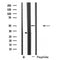 Western blot analysis of extracts from Hela, using RAD51L2 Antibody. Lane 1 was treated with the antigen-specific peptide.