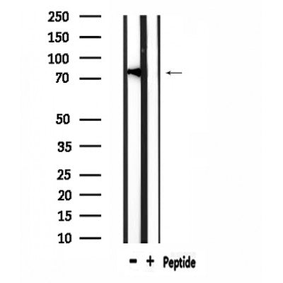 DF4646 at 1/100 staining Mouse testis tissue by IHC-P. The sample was formaldehyde fixed and a heat mediated antigen retrieval step in citrate buffer was performed. The sample was then blocked and incubated with the antibody for 1.5 hours at 22¡ãC. An HRP conjugated goat anti-rabbit antibody was used as the secondary