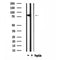 DF4646 at 1/100 staining Mouse testis tissue by IHC-P. The sample was formaldehyde fixed and a heat mediated antigen retrieval step in citrate buffer was performed. The sample was then blocked and incubated with the antibody for 1.5 hours at 22¡ãC. An HRP conjugated goat anti-rabbit antibody was used as the secondary